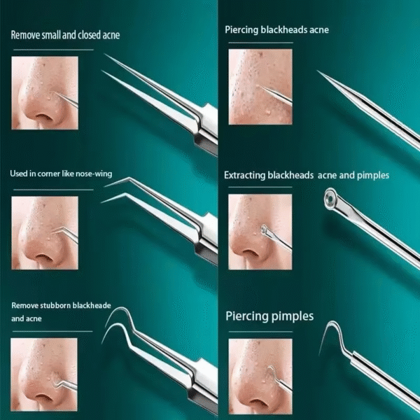 11Pcs Ingrown Hair Tweezers Acne Blackhead Removal Needles Black Dots Cleaner Pore Cleaner Deep Cleansing Face Skin Care Tools - Image 6